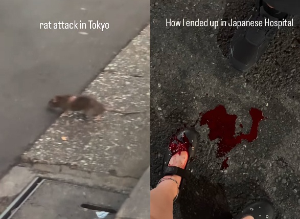 日本东京街头老鼠“横行”，女游客被咬伤出血