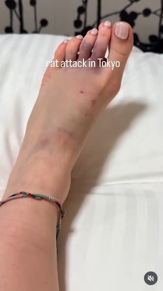 日本东京街头老鼠“横行”，女游客被咬伤出血