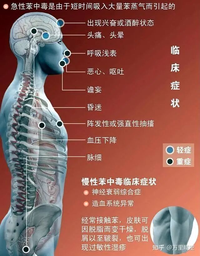 48岁男子刷油漆中毒! 昏迷20小时无人发现,抢救4天后离世! 曾发语音求救…