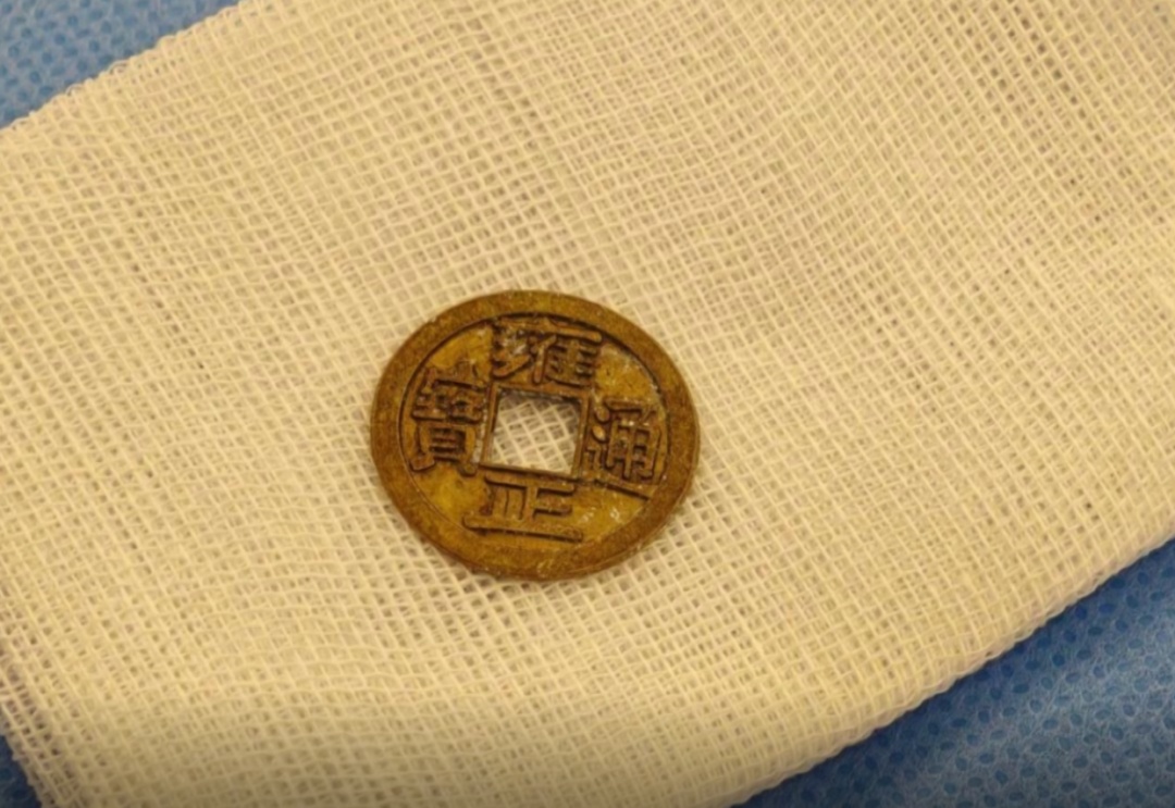 祈福币险变“夺命符” ！医生紧急提醒