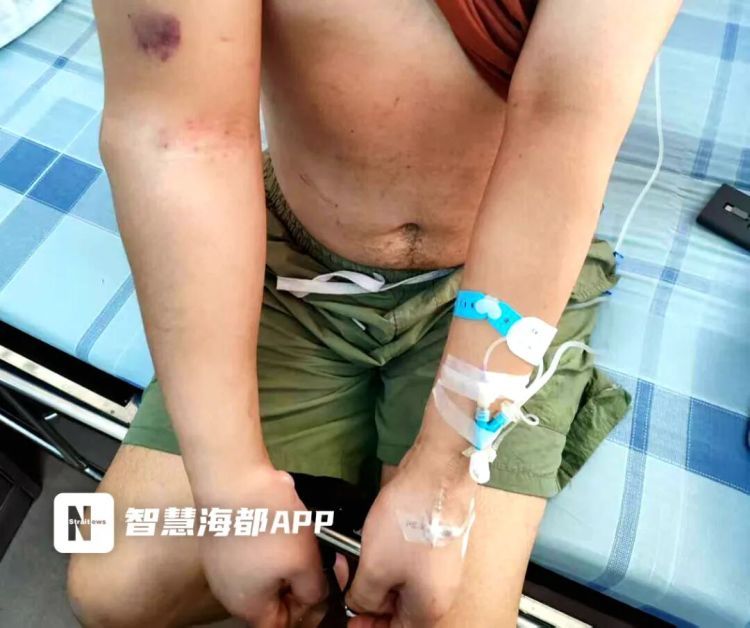 岁小伙醉酒后熟睡，差点废掉一条胳膊！警惕这5个危险信号