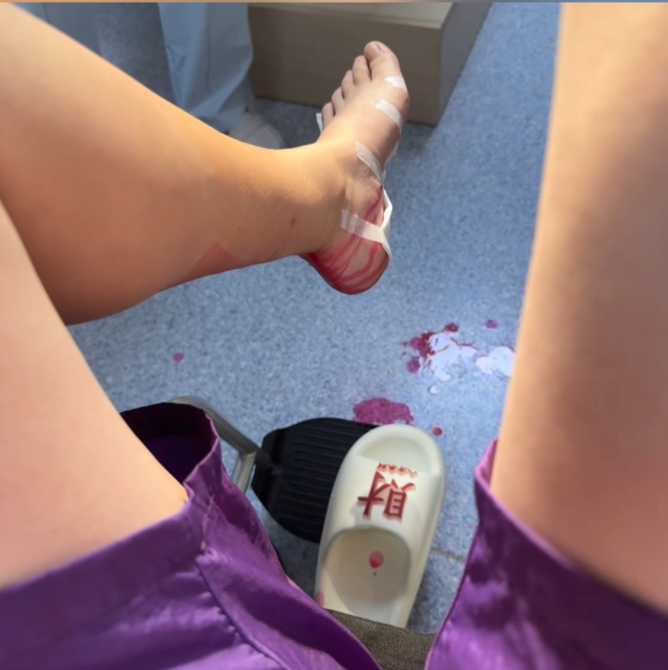 女子在家里突然脚底喷血！小心，这东西很多人在用