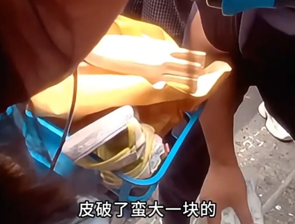 看着都疼！已售出几十万件，很多人租用共享单车时会使用