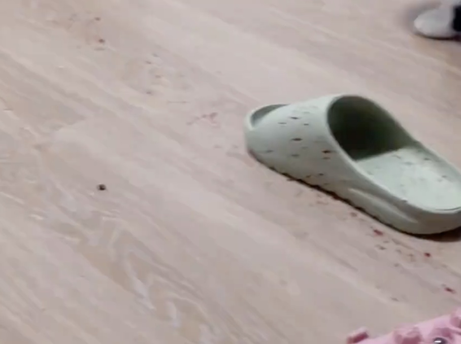 跟练20分钟,女子突然脚底“喷血”!这个网红运动产品很危险 跟练20分钟,女子突然脚底“喷血”!这个网红运动产品很危险