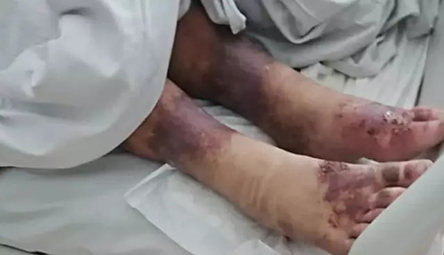 波兰少女被父母囚禁27年,一直被关在自己家中,获救时骨瘦如柴像个老妇人 波兰少女被父母囚禁27年,一直被关在自己家中,获救时骨瘦如柴像个老妇人