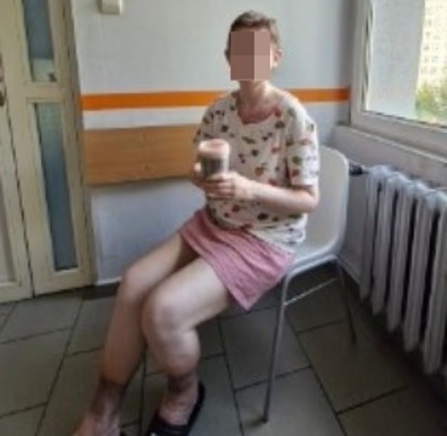 波兰少女被父母囚禁27年,一直被关在自己家中,获救时骨瘦如柴像个老妇人 波兰少女被父母囚禁27年,一直被关在自己家中,获救时骨瘦如柴像个老妇人