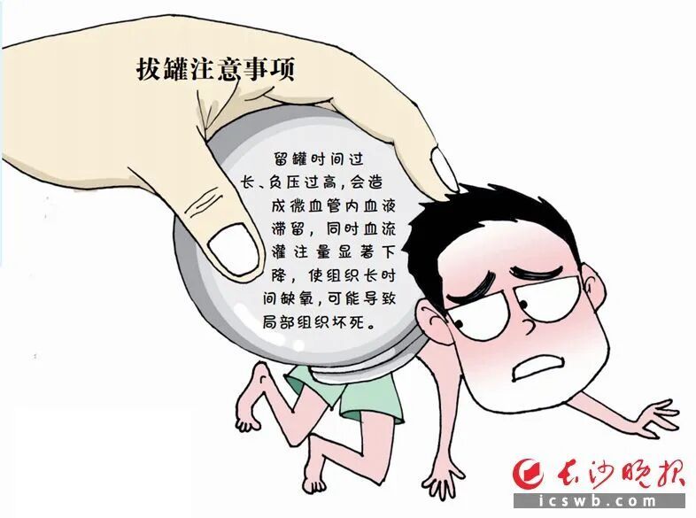 连拔2天火罐，突然高位截瘫！医生紧急提醒