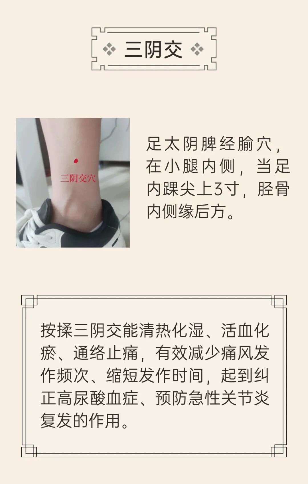 痛风一犯“痛不欲生”？别只靠忌口！7个穴位帮助减少发作