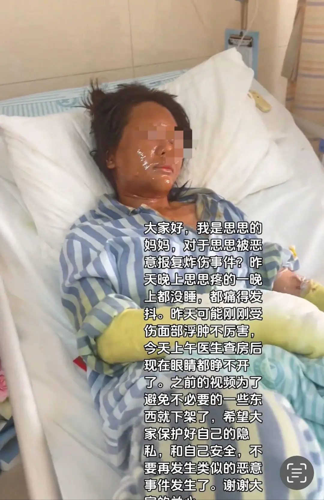 女主播家门口遭“伪装包裹”炸伤面部！警方：因个人矛盾！