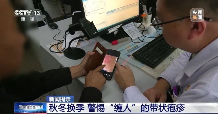 “最疼皮肤病”进入高发期！出现这些疼痛信号别大意