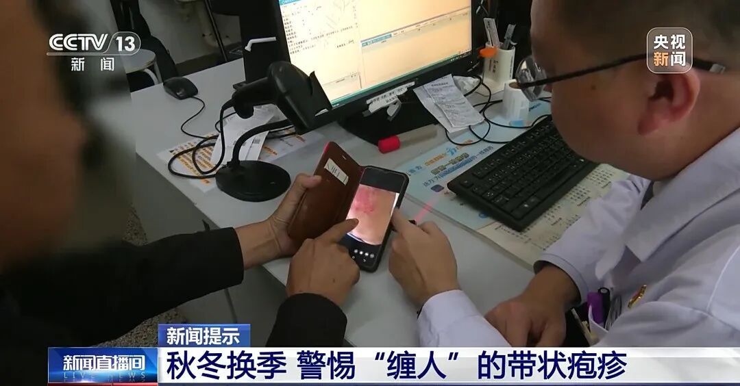这种皮肤病进入高发期! 这种皮肤病进入高发期!