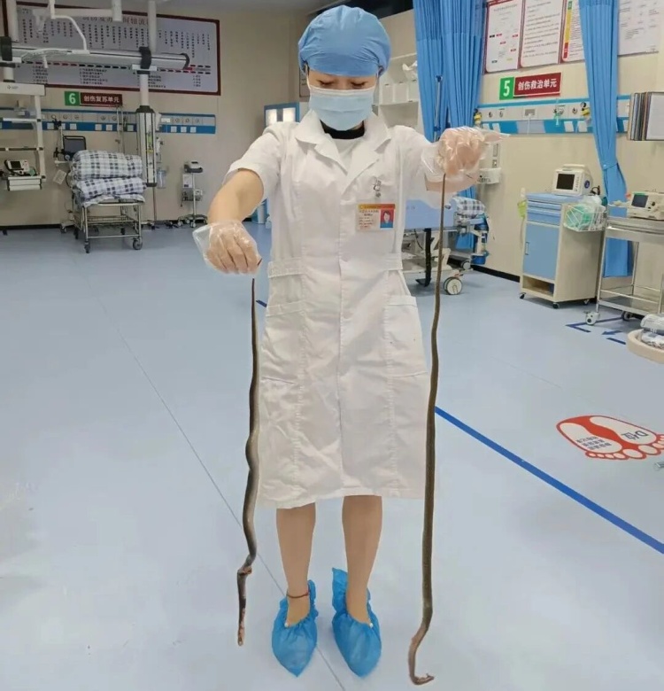被咬还打包凶手！广东62岁阿叔“提蛇看病”惊呆医生