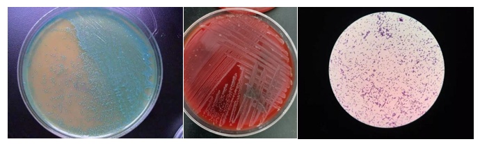 女子突然高烧39℃，送医当晚就流产！元凶很多人家中都有
