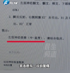 郑州小伙暴走后突然嘴歪眼斜！医生：气温骤降，这类患者激增2倍！