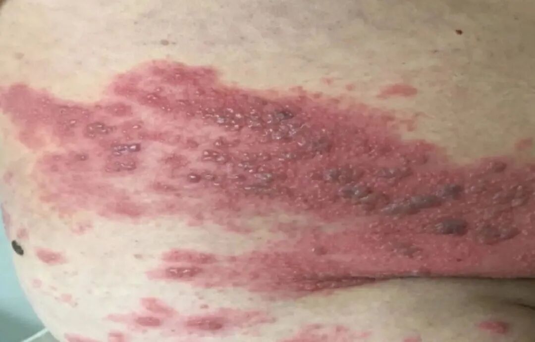 密密麻麻！常州一医院接诊超200例