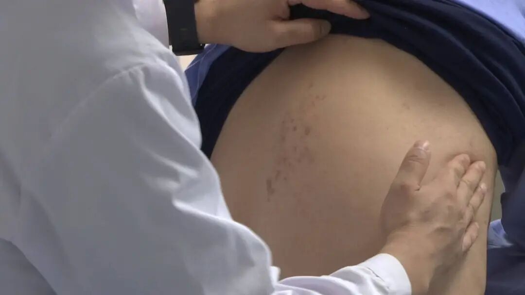 密密麻麻！常州一医院接诊超200例