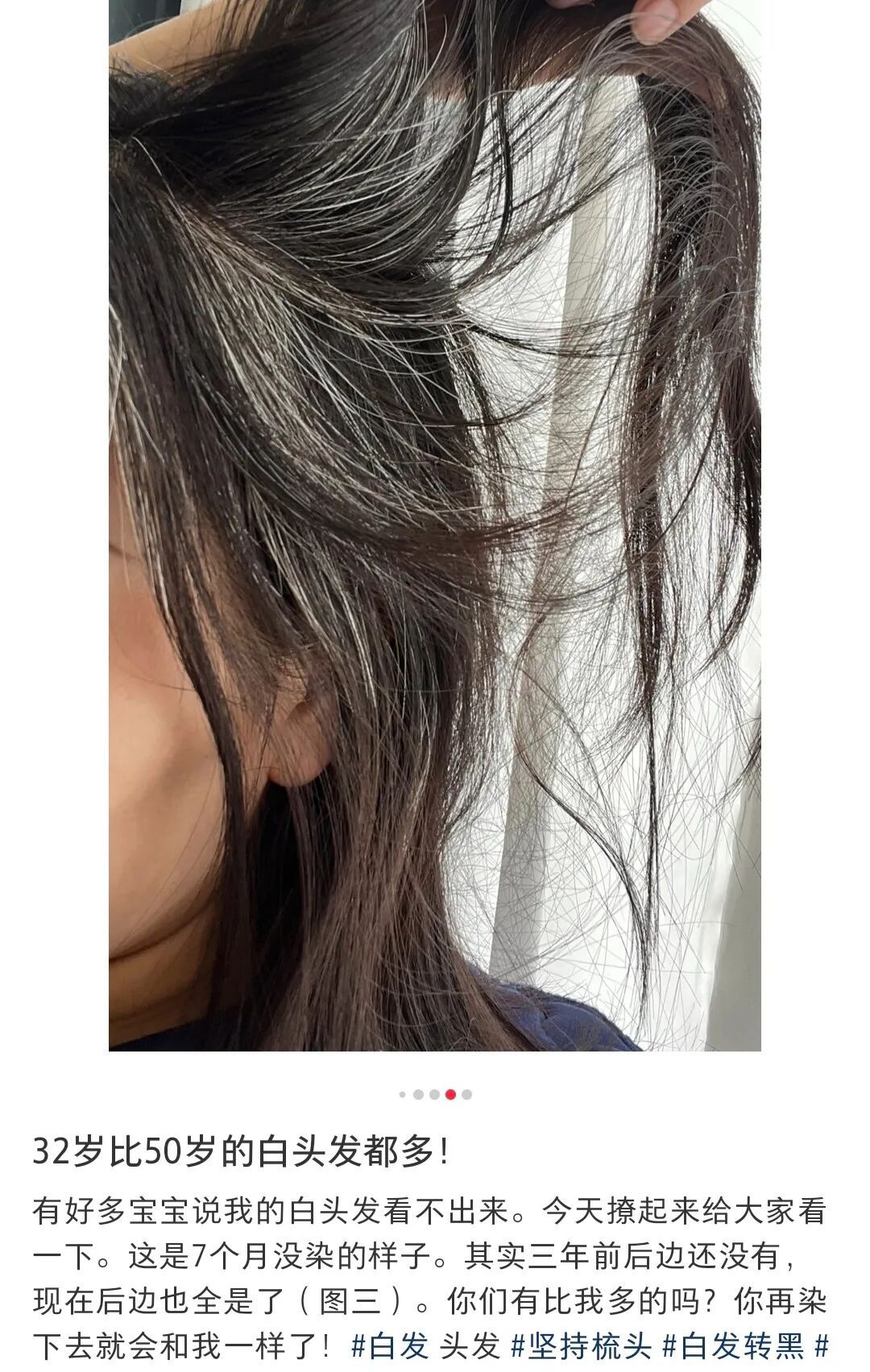 头发白了,还能再黑回去吗? 头发白了,还能再黑回去吗?