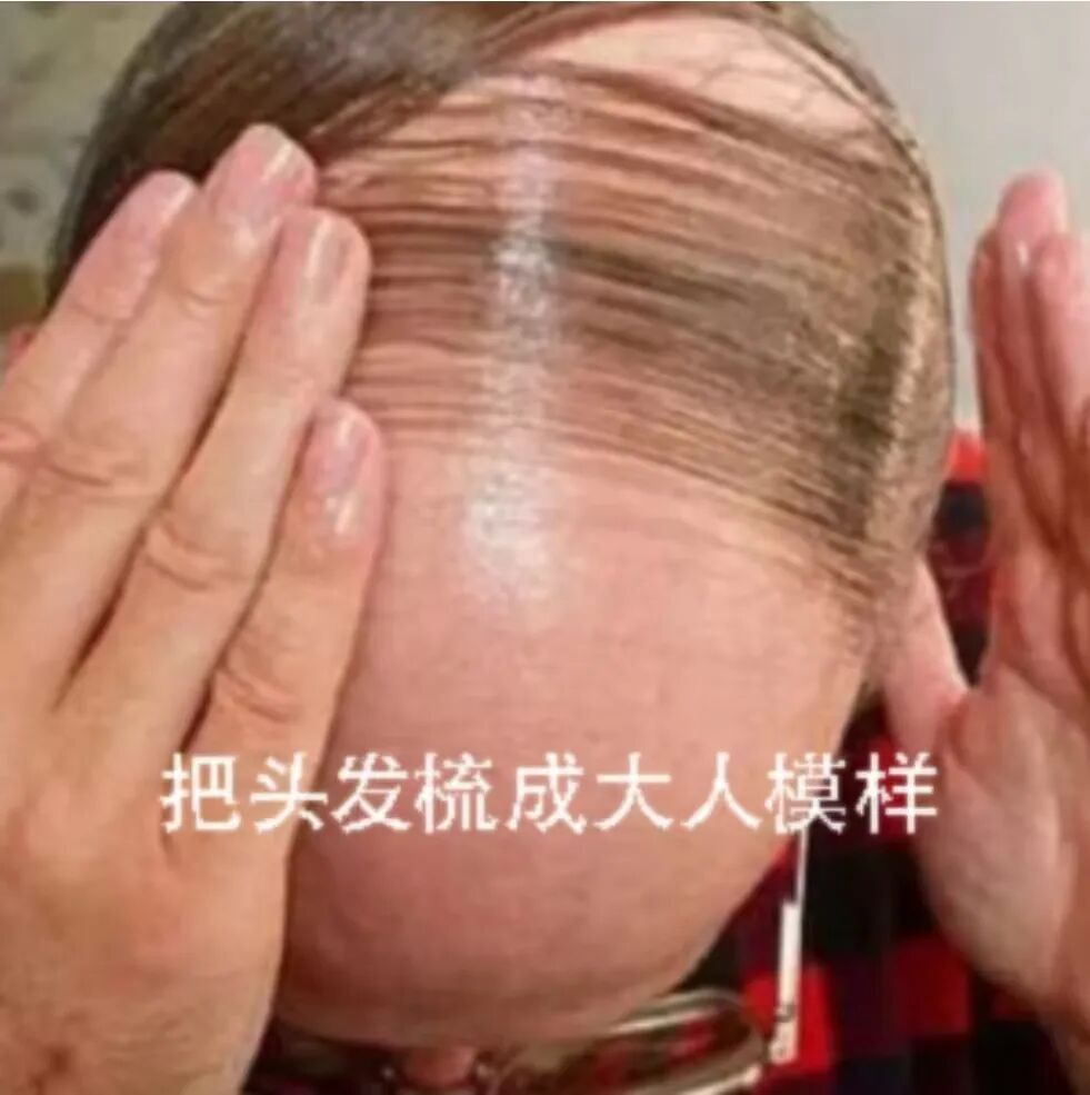 头发白了,还能再黑回去吗? 头发白了,还能再黑回去吗?