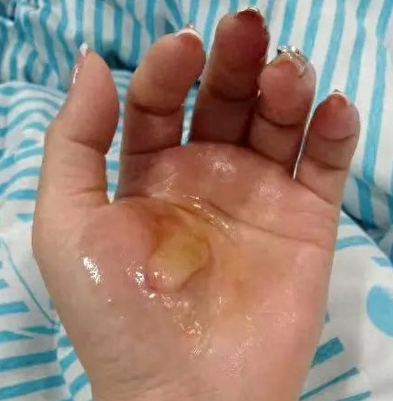 维修顶棚突遇“电老虎”，男子瞬间倒地不起！