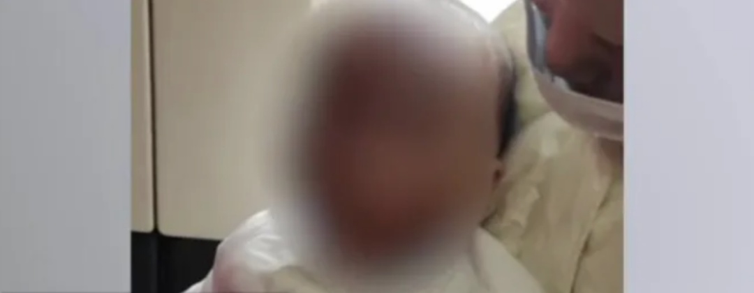 3岁男童不慎跌入炭火堆,全身85%烧伤 3岁男童不慎跌入炭火堆,全身85%烧伤