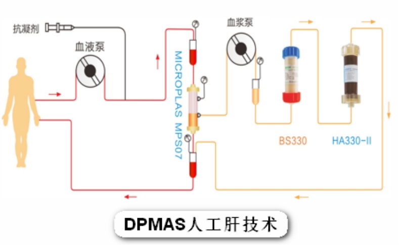 “人工肝”是人造的肝脏吗？