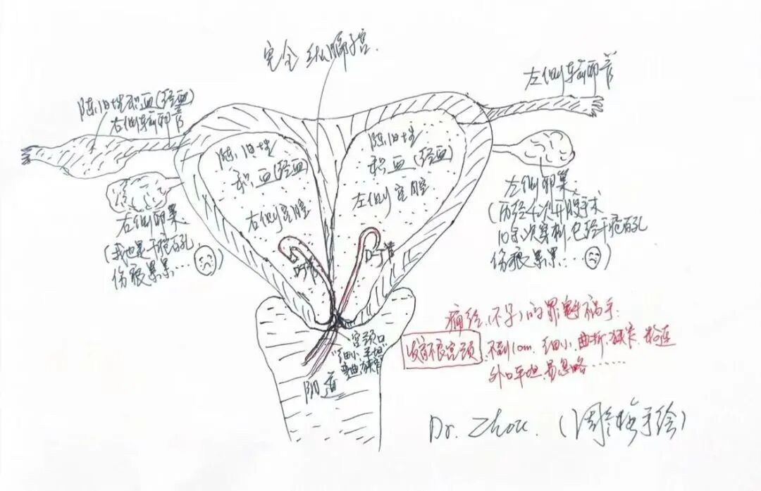 女子痛经30年4次开腹，竟因月经倒流，医生提醒：这些情况尽早就医