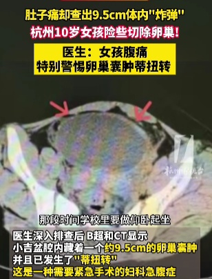 杭州10岁女孩险些被切除卵巢！医生紧急提醒