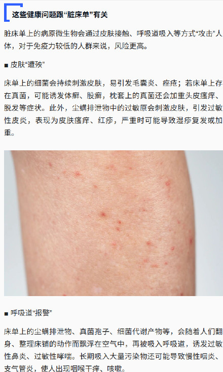 建议冬季每2周更换1次床单