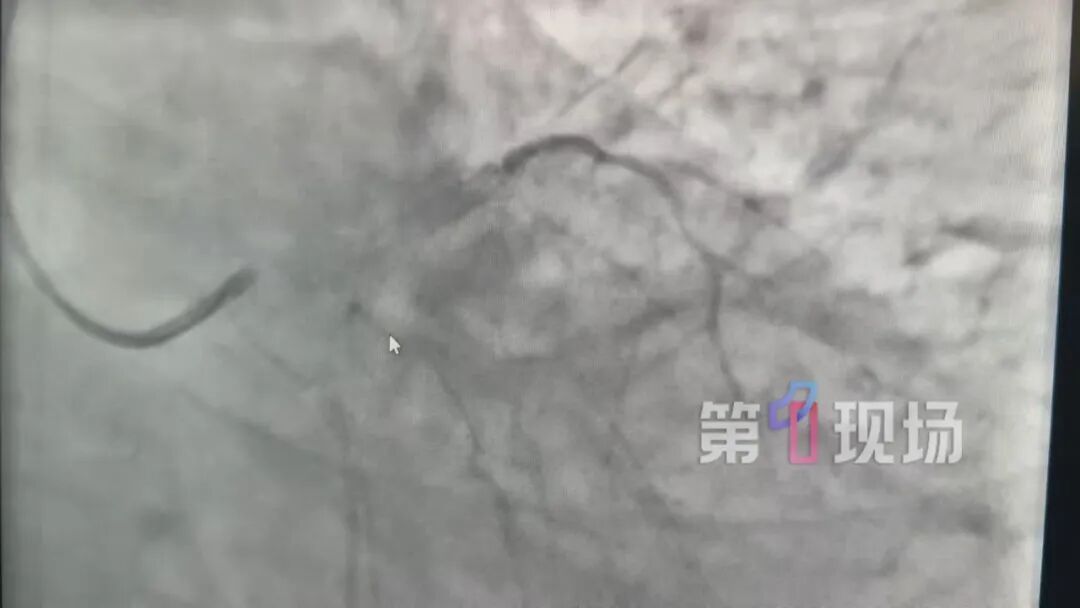 深圳一医院半天抢救5例！降温竟然会致命？