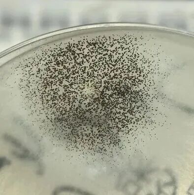 女孩咳嗽一年找不到原因,一查竟是肺部“发霉”了!这些细节别忽视 女孩咳嗽一年找不到原因,一查竟是肺部“发霉”了!这些细节别忽视