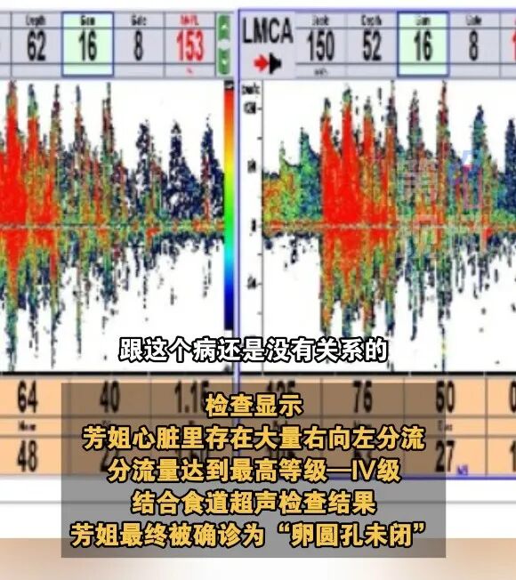 深圳一女子头疼20年，竟是因为心脏…