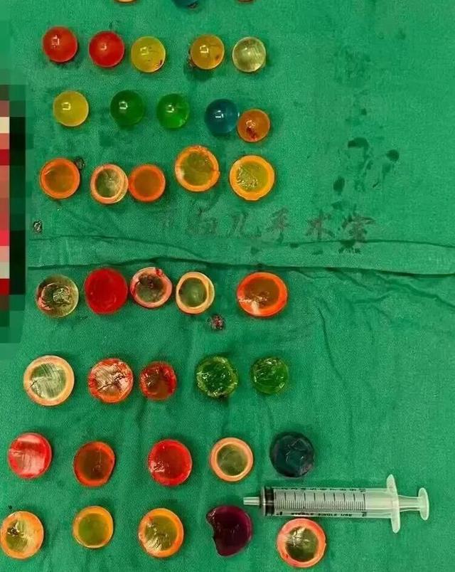14岁男孩往尿道塞38颗“水宝宝”,膀胱濒临“爆炸”!医生郑重提醒 14岁男孩往尿道塞38颗“水宝宝”,膀胱濒临“爆炸”!医生郑重提醒