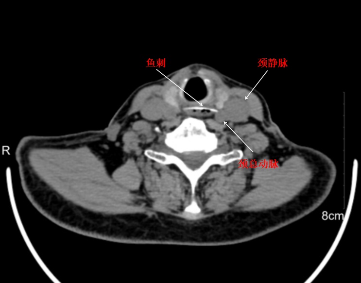 浙江阿姨深夜紧急送医，只因吃了一口……医生：这种做法大错特错