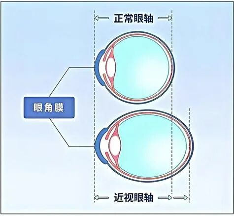 眼睛真的不会长大吗？