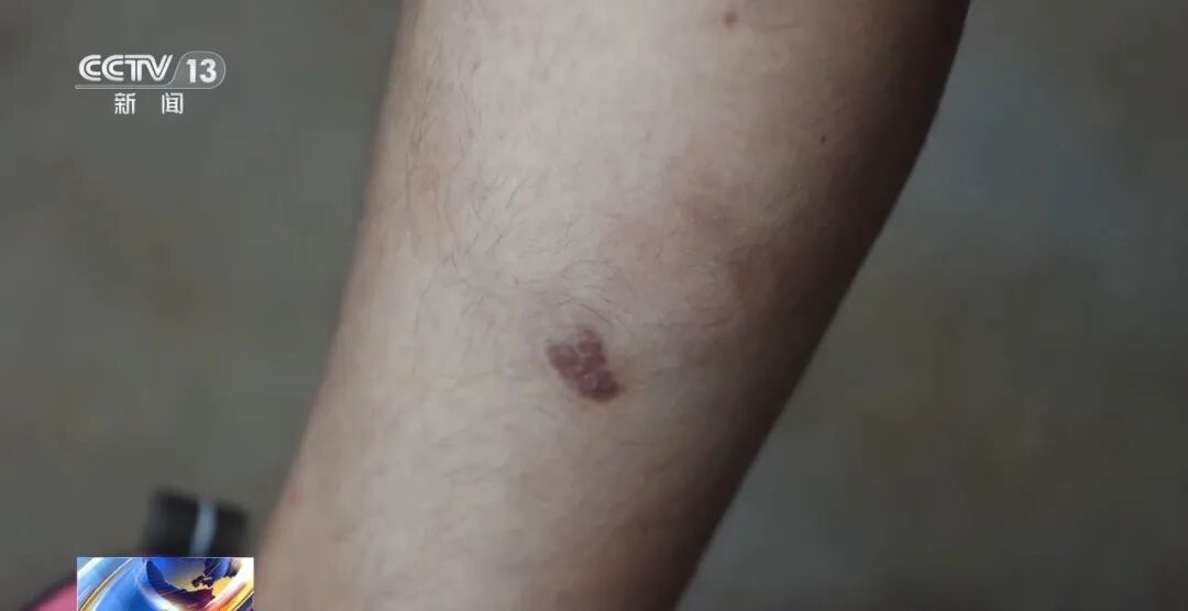 失联51天,18岁高中生讲述被骗至缅北经历 失联51天,18岁高中生讲述被骗至缅北经历