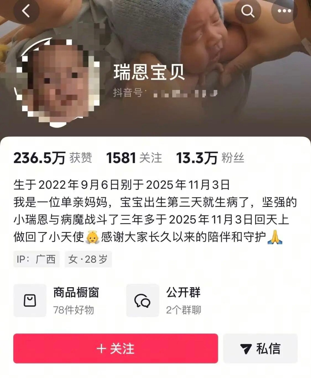 网红“瑞恩宝贝”去世，年仅3岁，生前被确诊罕见型基因突变