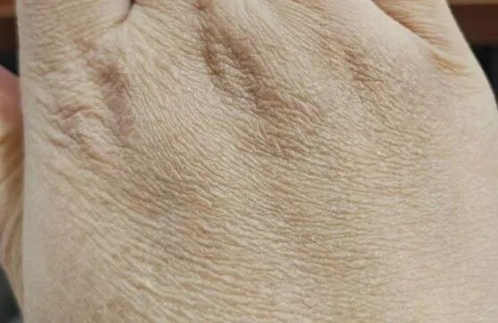 你的皮肤在“喊渴”?专家:这样补水才是真有效! 你的皮肤在“喊渴”?专家:这样补水才是真有效!