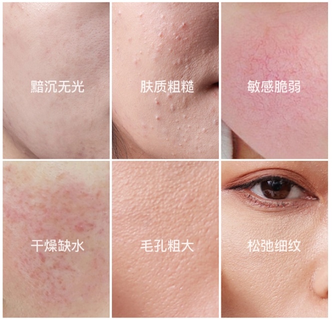 你的皮肤在“喊渴”?专家:这样补水才是真有效! 你的皮肤在“喊渴”?专家:这样补水才是真有效!