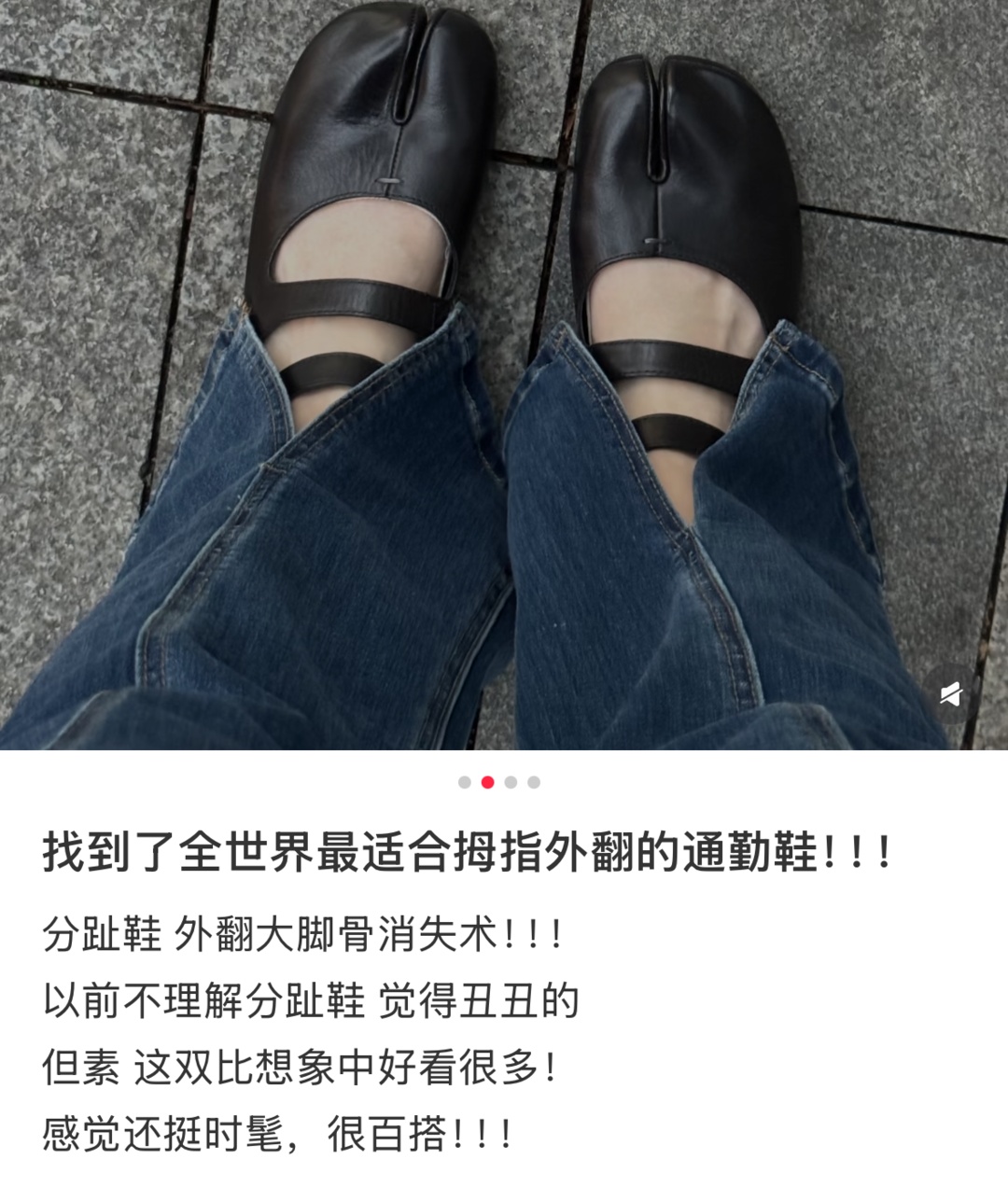 穿分趾鞋,能治拇外翻? 穿分趾鞋,能治拇外翻?