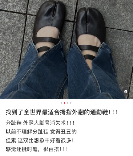 穿分趾鞋真能解决拇外翻吗？骨科医生教拇外翻这么选鞋