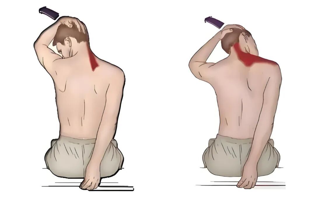 11岁女孩跑步时突然中风！这些症状早发现，真的能救命