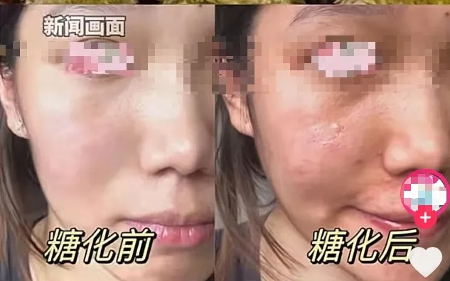 这种美食突然爆火！医生提醒→
