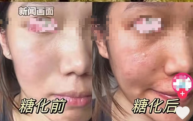 有人吃出“糖化脸”?降温后,这种美食爆火…… 有人吃出“糖化脸”?降温后,这种美食爆火……