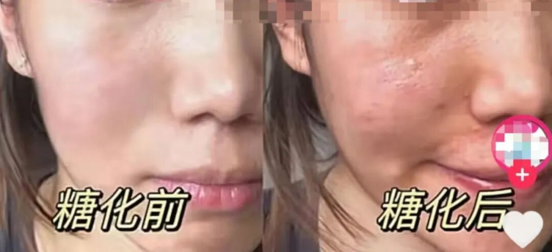 热搜第一!这种美食突然爆火,第一批“受害者”已出现……医生提醒 热搜第一!这种美食突然爆火,第一批“受害者”已出现……医生提醒