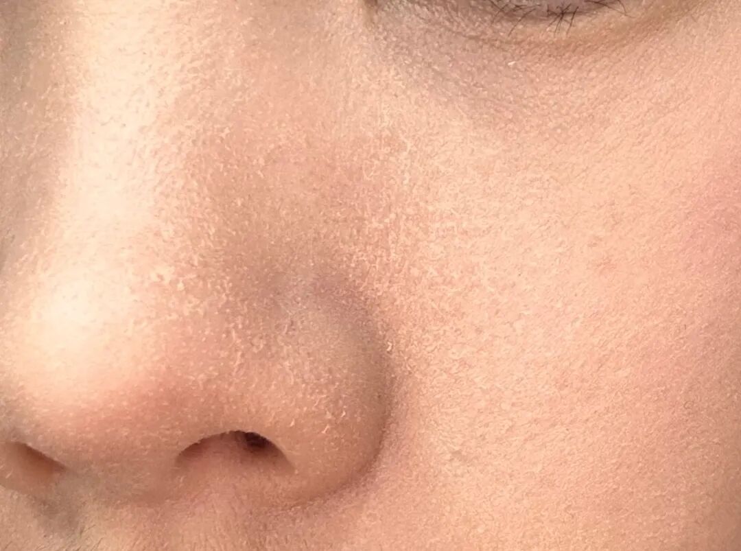 你的皮肤在“喊渴”?专家:这样补水才是真有效! 你的皮肤在“喊渴”?专家:这样补水才是真有效!