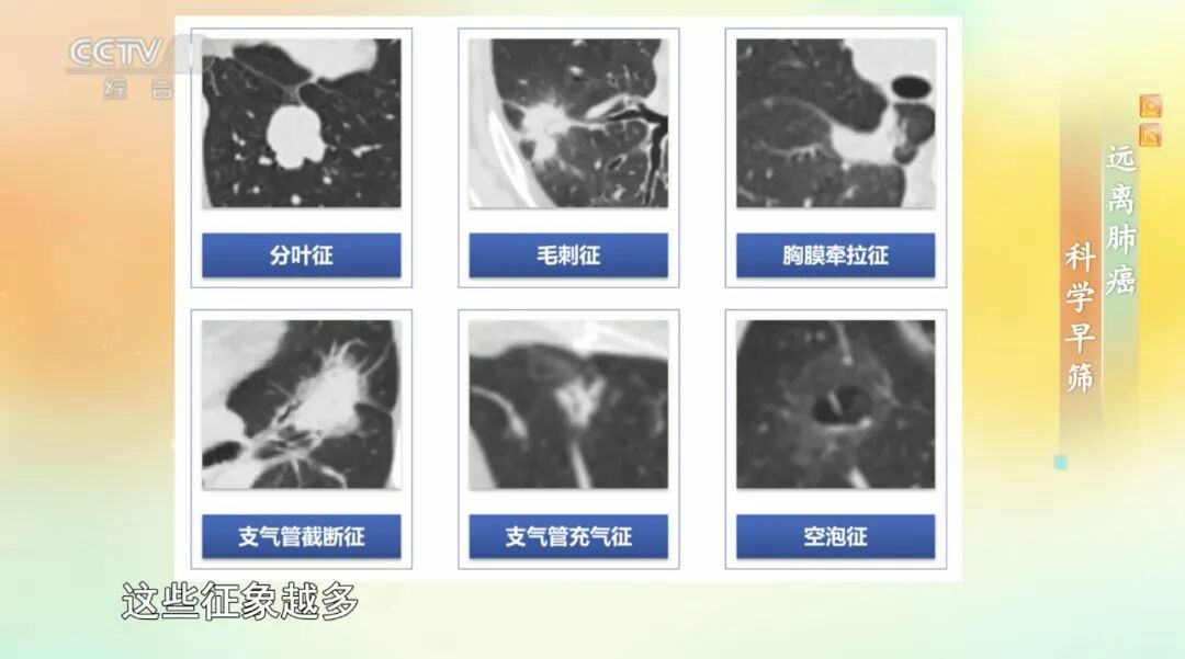 体检查出它别不在意,小心拖成癌!你家厨房可能就是诱发的高风险场地 体检查出它别不在意,小心拖成癌!你家厨房可能就是诱发的高风险场地