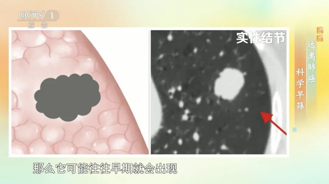 体检查出它别不在意,小心拖成癌!你家厨房可能就是诱发的高风险场地 体检查出它别不在意,小心拖成癌!你家厨房可能就是诱发的高风险场地