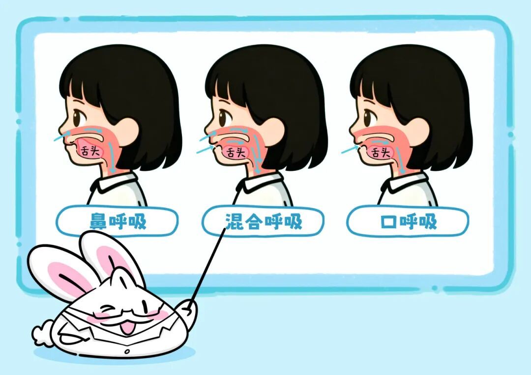 口呼吸，会悄悄地偷走你的颜值吗？