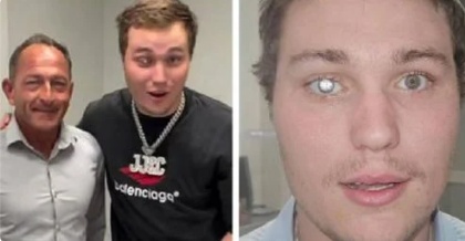 23岁珠宝商用钻石打造全球最贵义眼，价值1425万元