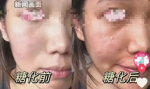 这款北京小吃爆火！排队俩小时也要吃它？医生紧急提醒→